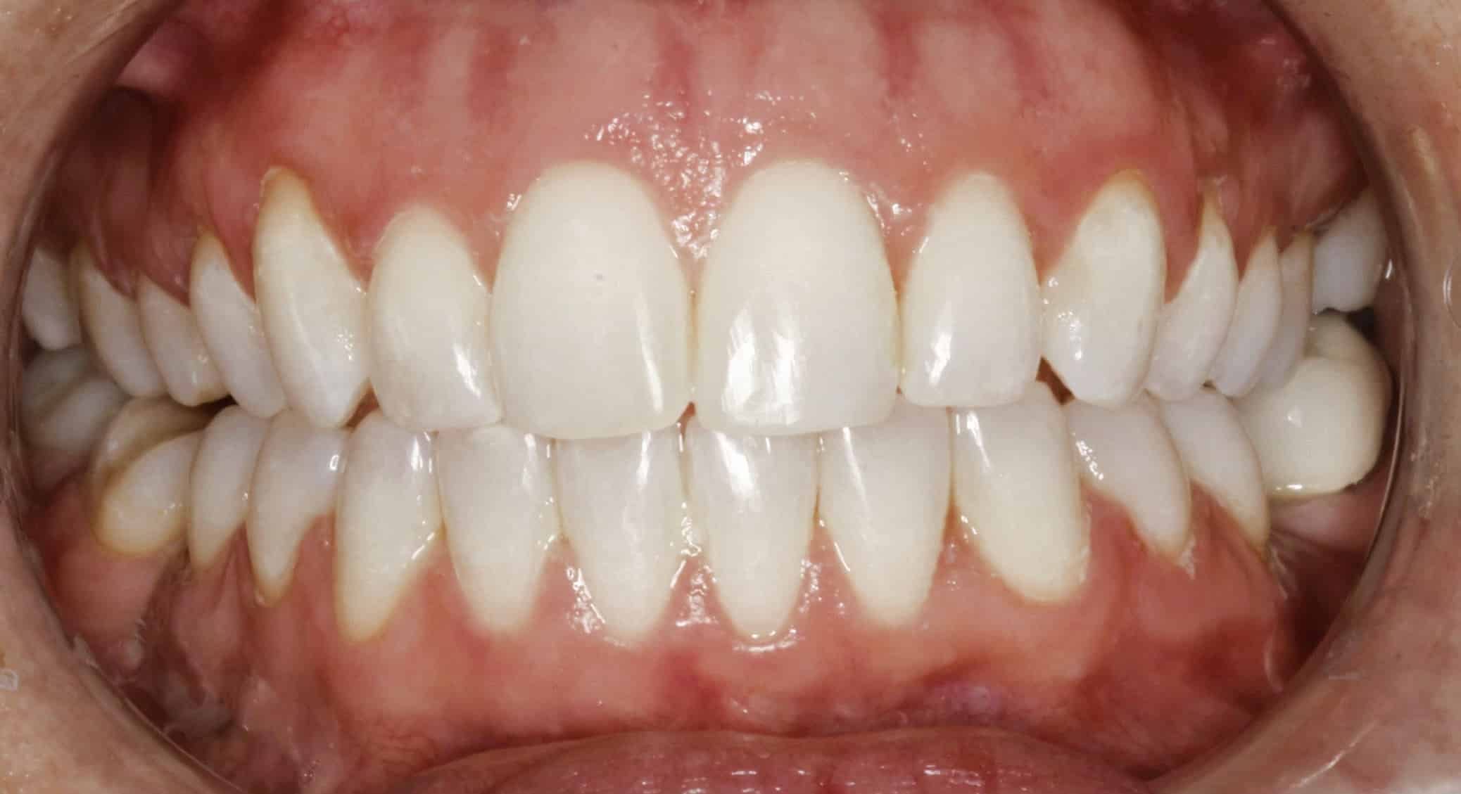 best Orthodontist 95610