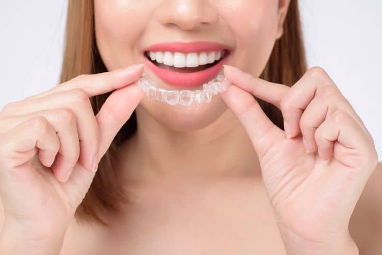 All About Invisalign