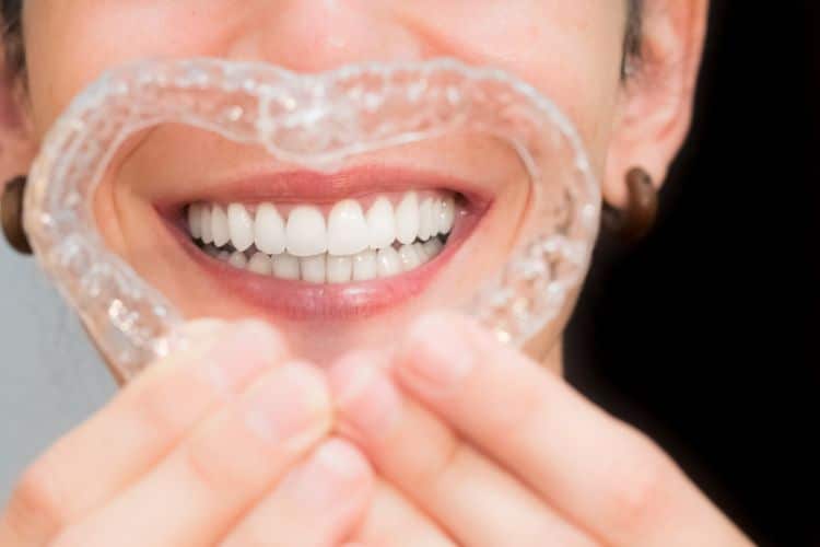 Maintenance Tips for Clear Aligners