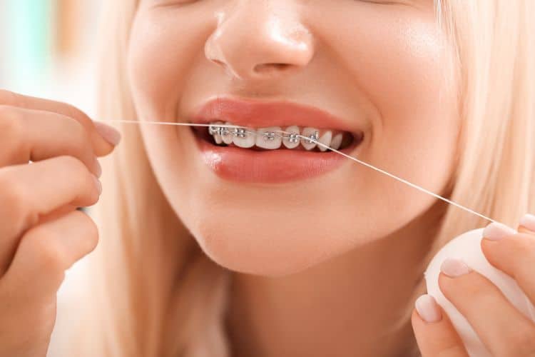 How to Care for Your Braces